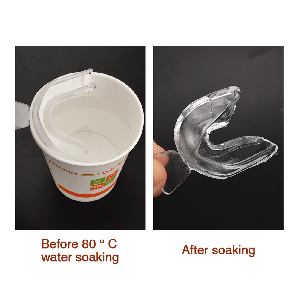 2-10pcs Silicone Mouth Guard O - огляд і ціна Teeth Whitening With Braces