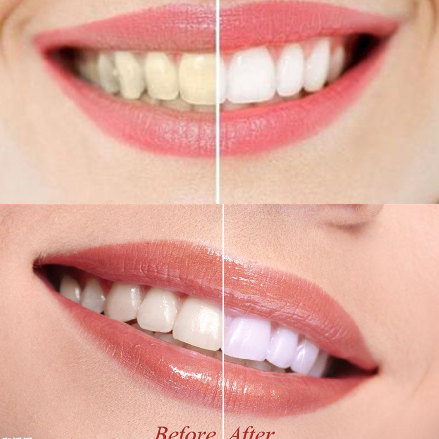 Bamboo Charcoal Teeth Tooth De - огляд і ціна Teeth Whitening Instant