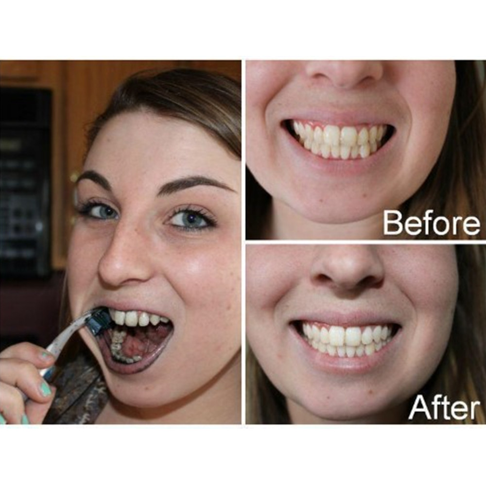 Bamboo Charcoal Teeth Tooth De - огляд і ціна Teeth Whitening Instant