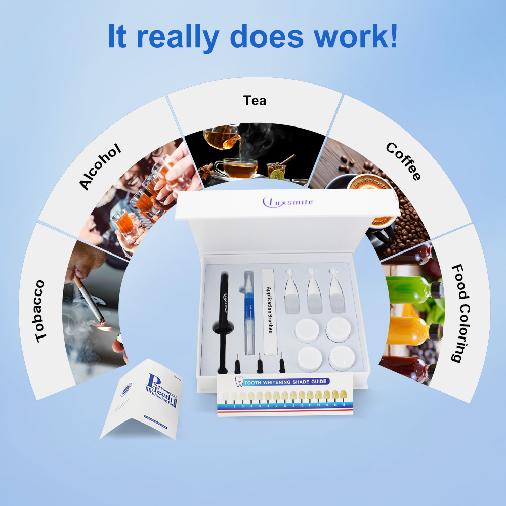 Teeth Whitening kit Profession - огляд і ціна Teeth Whitening Kit At Home