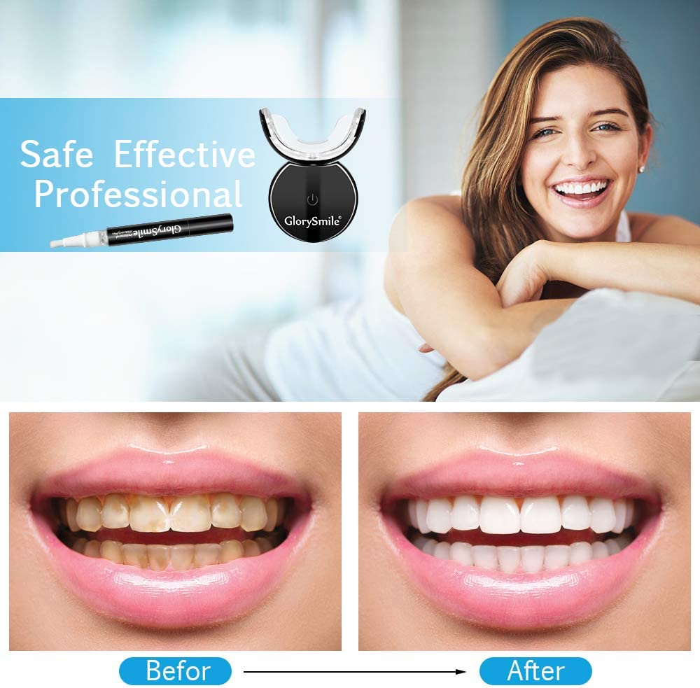 Glorysmile Salon Non Peroxide  - огляд і ціна Teeth Whitening Led Kit