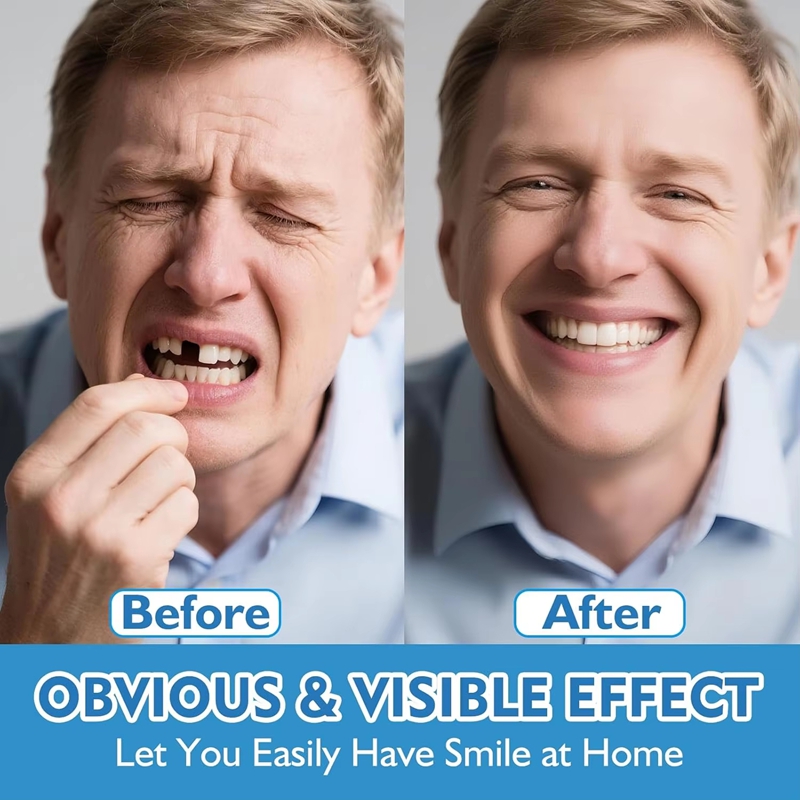 Full Set Silicone Dentures Upp - огляд і ціна Teeth Whitening Instant