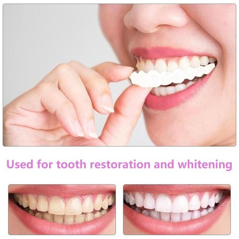 Snap On Teeth Veneers Instant  - огляд і ціна Teeth Whitening Instant