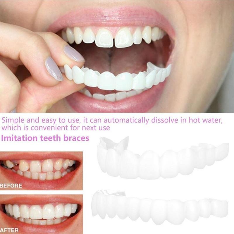 Snap On Teeth Veneers Instant  - огляд і ціна Teeth Whitening Instant