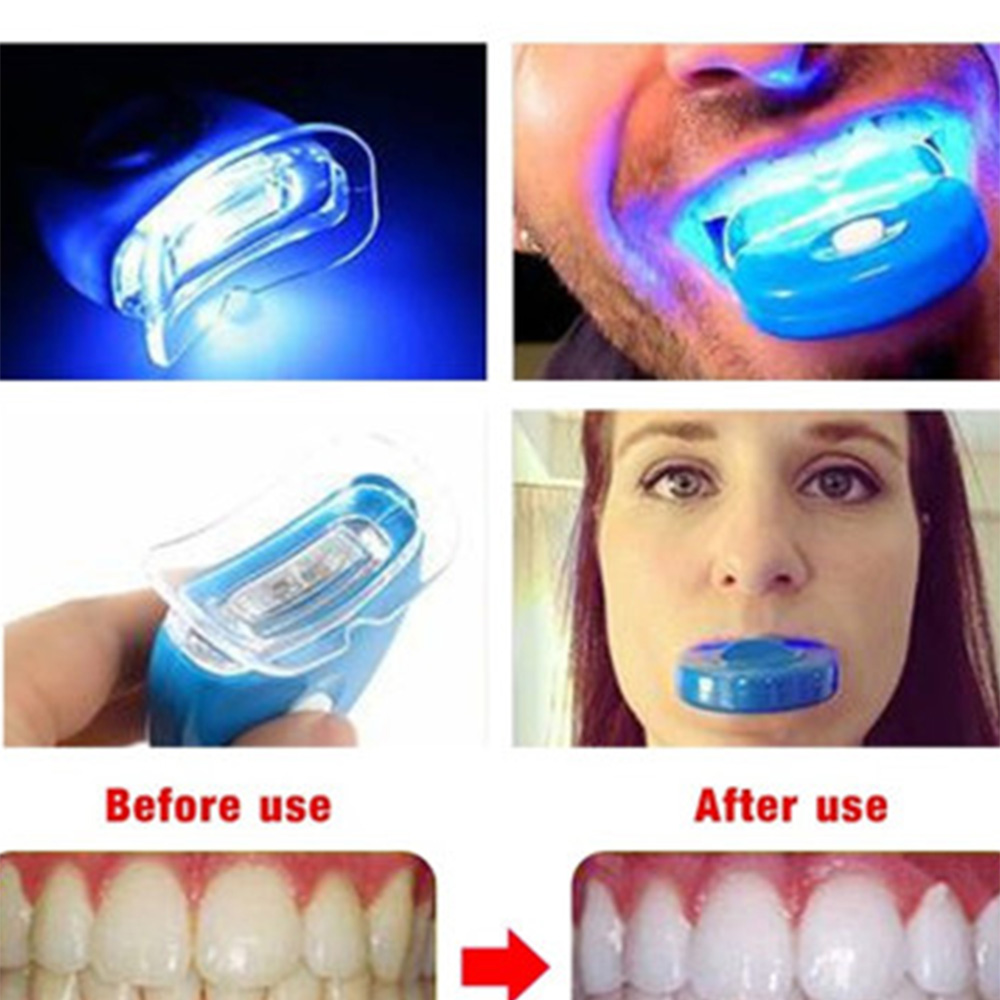 New Blue Led Teeth Whitening A - огляд і ціна Teeth Whitening Laser