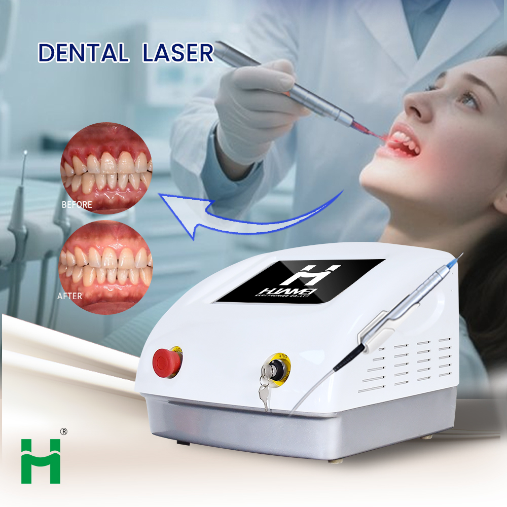 Portable LED Teeth Whitening K - огляд і ціна Teeth Whitening Led Kit